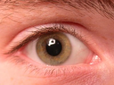 Eye