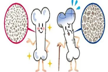Osteoporosis jigsaw puzzle