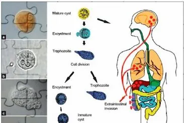 AMEBIASIS.