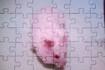scabers jigsaw puzzle
