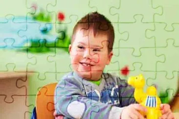 sindrome down