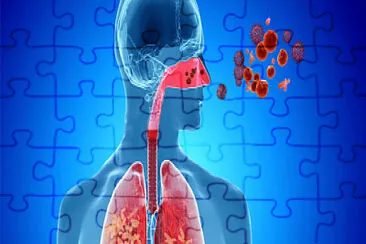 ENFERMEDADES POR CONTAMINACION jigsaw puzzle