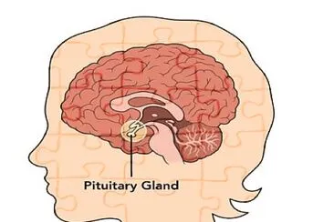 Pituitaria