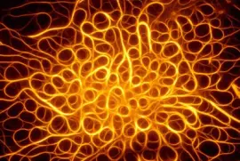 microfilamentos de actina