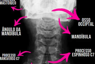 Coluna Cervical jigsaw puzzle