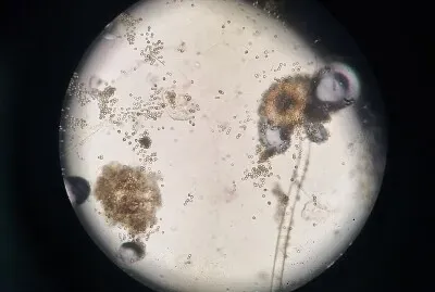 Aspergillus niger