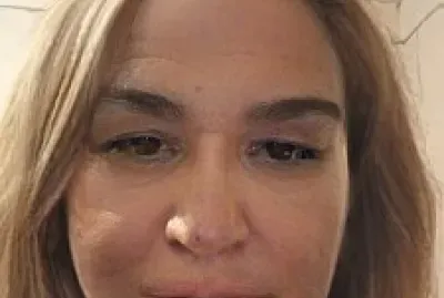 rostro