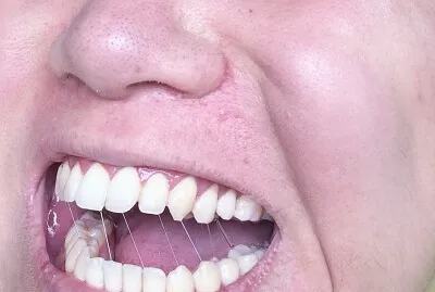 Smile puzzle 3