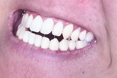teeth