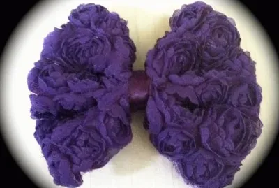 Mesh Bow Hair Clip jigsaw puzzle