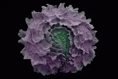 cabbage