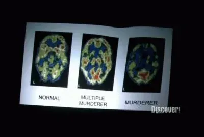 Brains