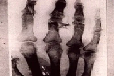 57