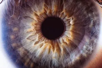 ojo