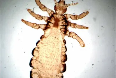 Pidocchio