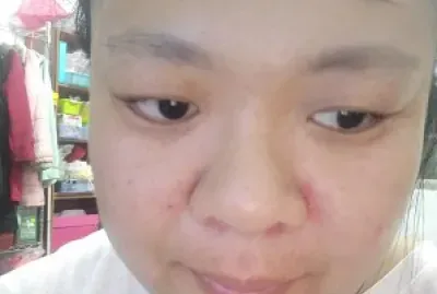 è‡ªæ‹