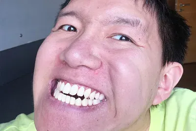 4