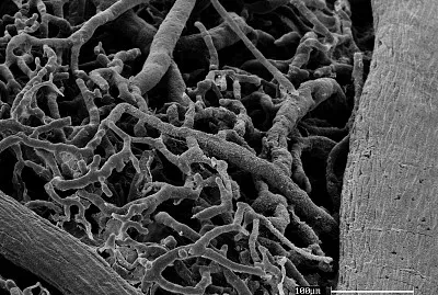 CÃ©lula pre-osteoblÃ¡stica