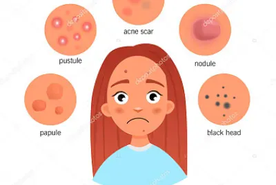 Cambios emocionales jigsaw puzzle