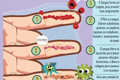 Aula Enf Dermatologica