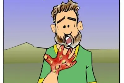 Leprosy jigsaw puzzle