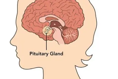 Pituitaria