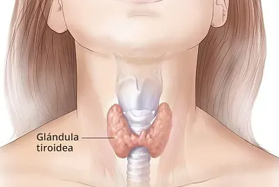 Tiroides