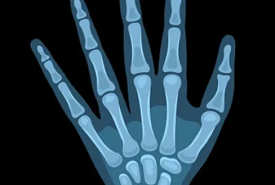 Radiografia de mano jigsaw puzzle