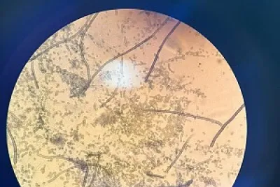 Cladosporium sp jigsaw puzzle