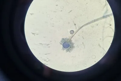 Fungo zygomiceto jigsaw puzzle