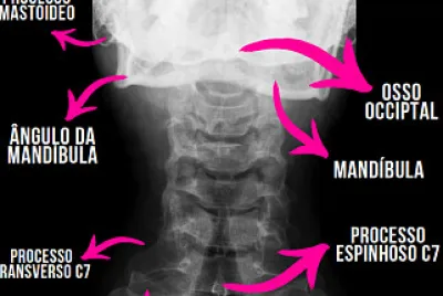 Coluna Cervical jigsaw puzzle