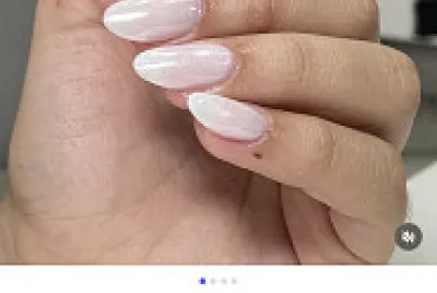 Unhas