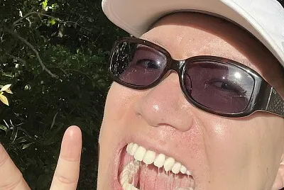 smile p2