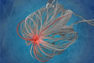nanoparticle
