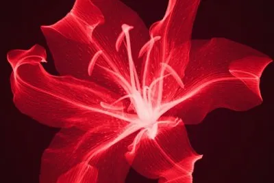 xray