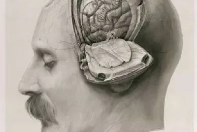 cerebro