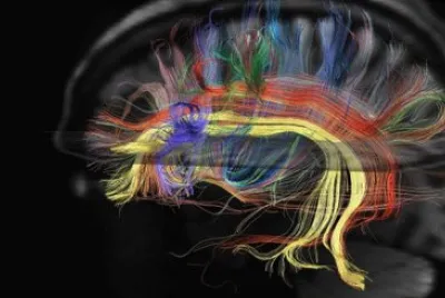 TELARAÃ‘AS EN EL CEREBRO