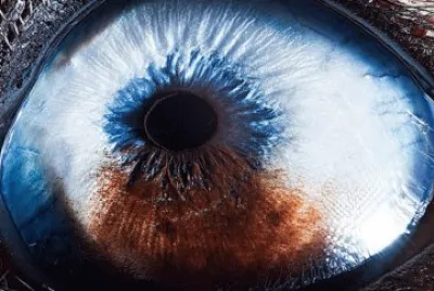 OJO