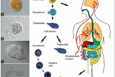 AMEBIASIS. jigsaw puzzle