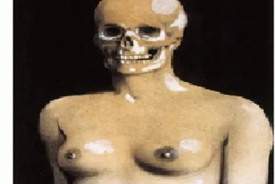 255