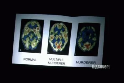 Brains
