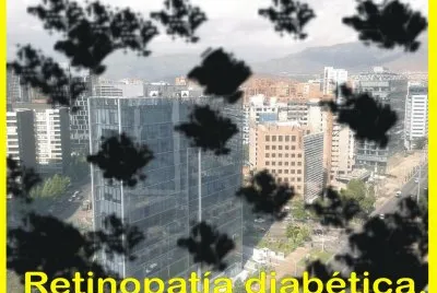 RETINOPATÃA DIABÃ‰TICA. jigsaw puzzle