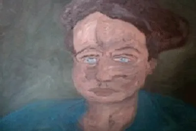 179