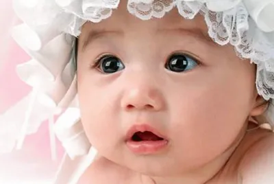 cara de bebe