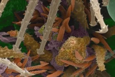 פאזל של torilis arvensis (microscopio)