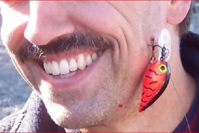 BONITO ARETE