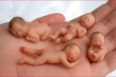 BEBÃ‰S DE AZUCAR