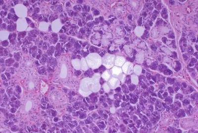 GlÃ¡ndula Salival