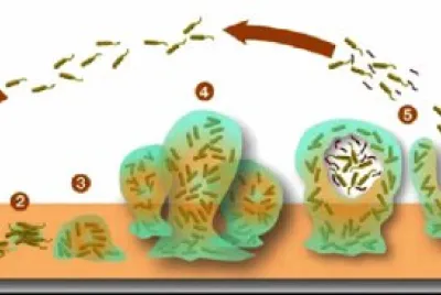 Â¿QuÃ© es una biopelÃ­cula