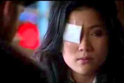 Happy with eye patch - Satellite Of Love